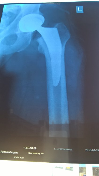 WP_20180421_18_04_16_Pro.thumb.jpg.dd4ee5e9c5a241005a627eb75e4b95cf.jpg