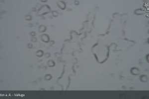 Kamera St. Anton am Arlberg  Valuga (LIVE Stream)