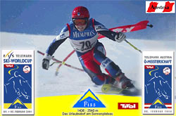 TVB Fiss